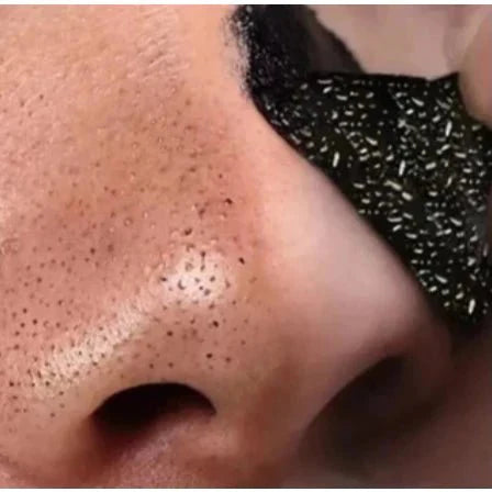 Adesivo Removedor de Cravos com Carvão Ativado - KIT 10 UNIDADES